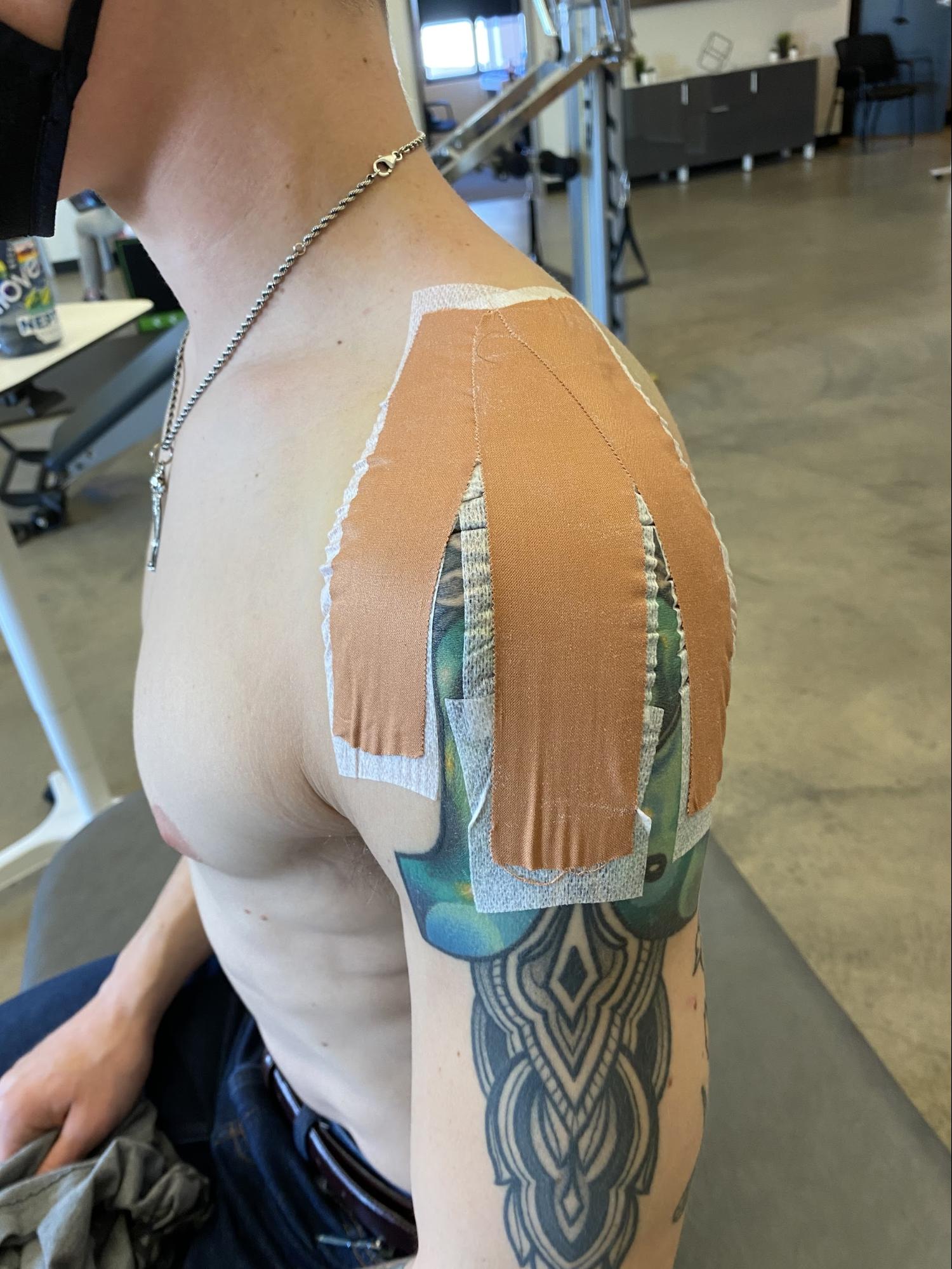 Sports Taping / Strapping in Boulder, CO
